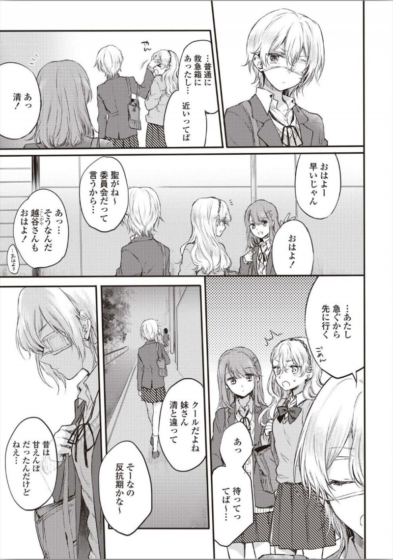 社交的で人気者の姉と正反対な陰キャJKが無防備に居眠りしている姉にキスしようとして寝たフリをしていた姉に逆に押し倒され、妹が眼帯で隠している自分と同じ色の目を舐める！