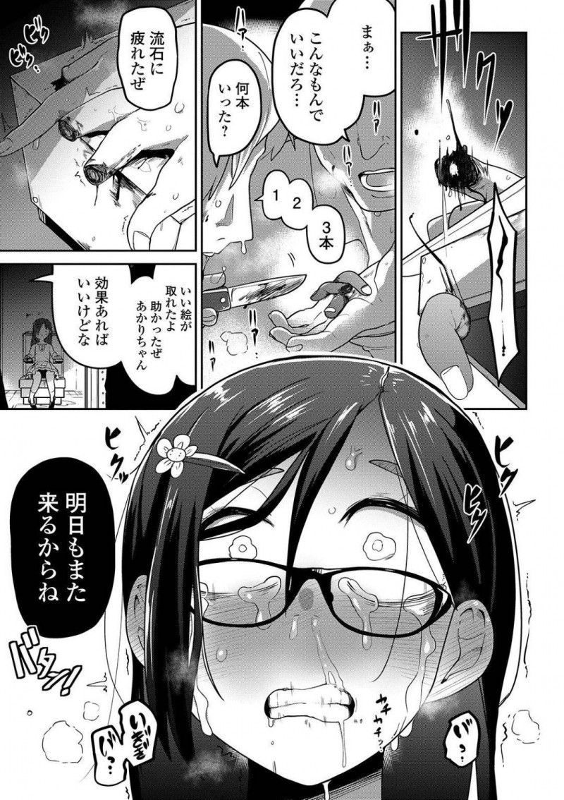 【エロ漫画】優しい里親に恵まれたが遊びに帰った孤児院である噂を耳にした少女…その噂の大元であるあしながおじさんを1人訪ね、そこから監禁拷問の日々が始まった！【つくすん：ビデオレター】